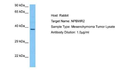 Western Blot: GPR8 Antibody [NBP2-86660] - Host: Rabbit. Target Name: NPBWR2. Sample Tissue: Human Mesenchymoma Tumor lysates. Antibody Dilution: 1ug/ml