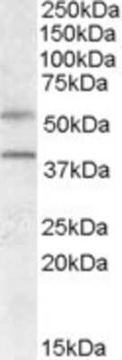 Western Blot: GPR81 Antibody [NBP1-51956] - Analysis of GPR81 in Human Liver lysate (35ug protein in RIPA buffer) using NBP1-51956 at 0.5g/ml. Primary incubation was 1 hour. Detected by chemiluminescence.