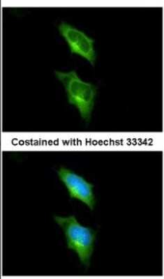 Immunocytochemistry/Immunofluorescence: GPR82 Antibody [NBP2-16725] - Immunofluorescence analysis of methanol-fixed HeLa, using antibody at 1:200 dilution.