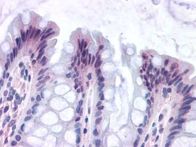 Immunohistochemistry-Paraffin: GPR82 Antibody [NLS2706] - Analysis of anti-GPR82 antibody with human colon.