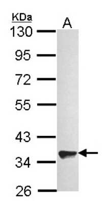 Western Blot: GPR82 Antibody [NBP2-16725] - Sample (30 ug of whole cell lysate) A: A549 10% SDS PAGE gel, diluted at 1:1000.