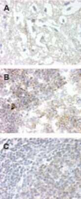 Immunohistochemistry-Paraffin: GPR83 Antibody [NBP2-24515] - Analysis of frozen brain (neurons & glia, image A), frozen tonsil tissue (lymphocytes, image B), and formalin-fixed paraffin embedded tonsil tissue using GPR83 antibody at 20 ug/ml.
