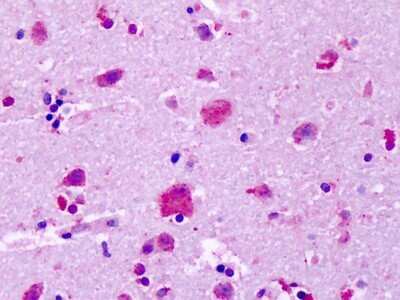 Immunohistochemistry-Paraffin: GPR83 Antibody [NLS4954] - Analysis of anti-GPR83 antibody with human brain, cortex, neurons at dilution 9-18 ug/ml.