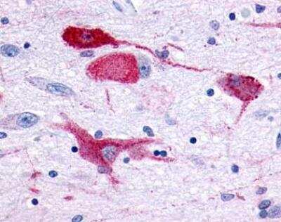 Immunohistochemistry-Paraffin: GPR83 Antibody [NLS4957] - Analysis of anti-GPR83 antibody with human brain, neurons and glia.