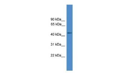 Western Blot: GPR83 Antibody [NBP2-82241] - WB Suggested Anti-GPR83 Antibody Titration: 0.2-1 ug/ml. ELISA Titer: 1:312500. Positive Control: 721_B cell lysate