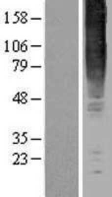 Western Blot GPR83 Overexpression Lysate