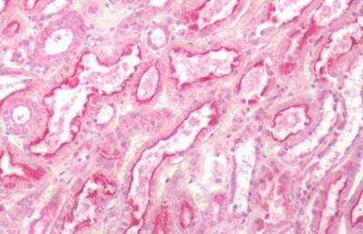 Immunohistochemistry-Paraffin: GPR84 Antibody [NBP3-06670] - Human Kidney: Formalin-Fixed, Paraffin-Embedded (FFPE)