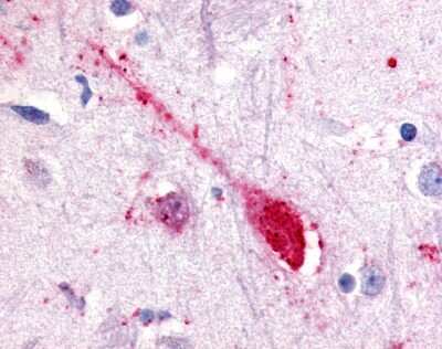 Immunohistochemistry-Paraffin: GPR85 Antibody [NLS339] - Analysis of anti-GPR85 antibody with human putamen, neuron.