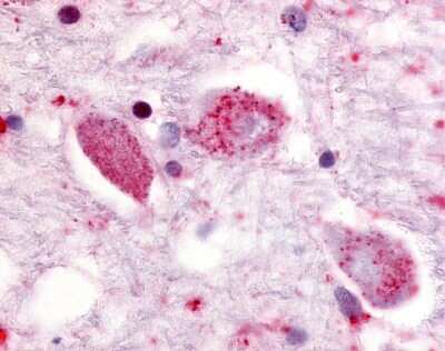 Immunohistochemistry-Paraffin: GPR85 Antibody [NLS341] - Analysis of anti-GPR85 antibody with human putamen, neurons at 10 ug/ml.