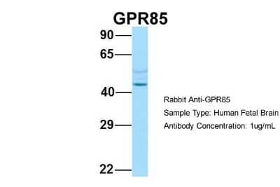 Western Blot: GPR85 Antibody [NBP2-82242] - Host: Rabbit. Target Name: GPR85. Sample Type: Human Fetal Brain. Antibody Dilution: 1.0ug/ml