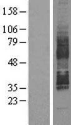 Western Blot: GPR85 Overexpression Lysate (Adult Normal) [NBL1-11298] Left-Empty vector transfected control cell lysate (HEK293 cell lysate); Right -Over-expression Lysate for GPR85.