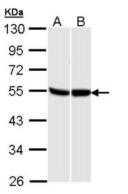 Western Blot: GPR87 Antibody [NBP2-16728] - Sample (30 ug of whole cell lysate) A: 293T B: H1299 10% SDS PAGE gel, diluted at 1:1000.