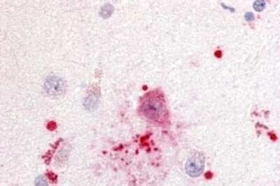 Immunohistochemistry-Paraffin: GPR88 Antibody [NLS6324] - Anti-GPR88 antibody IHC of human brain, neurons and glia. Immunohistochemistry of formalin-fixed, paraffin-embedded tissue after heat-induced antigen retrieval.