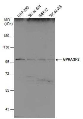 Western Blot: GPRASP2 Antibody [NBP2-16729] - Various whole cell extracts (30 ug) were separated by 7.5% SDS-PAGE, and the membrane was blotted with GPRASP2 antibody diluted at 1:500.