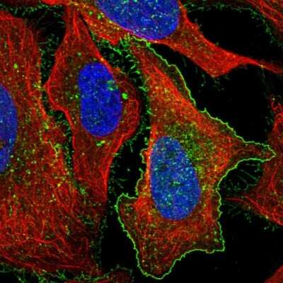 Immunocytochemistry/Immunofluorescence: GPRC5A/RAI3 Antibody [NBP2-58188] - Staining of human cell line U-2 OS shows localization to plasma membrane & vesicles.