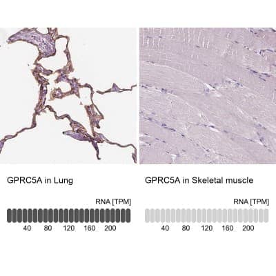 Immunohistochemistry-Paraffin: GPRC5A/RAI3 Antibody [NBP1-89743] - Analysis in human lung and skeletal muscle tissues. Corresponding GPRC5A RNA-seq data are presented for the same tissues.