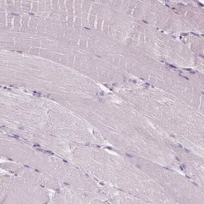 Immunohistochemistry-Paraffin: GPRC5A/RAI3 Antibody [NBP1-89743] - Staining of human skeletal muscle shows no positivity in myocytes as expected.