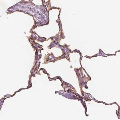Immunohistochemistry-Paraffin: GPRC5A/RAI3 Antibody [NBP1-89743] - Staining of human lung shows moderate membranous positivity in pneumocytes.