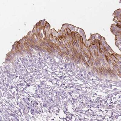 Immunohistochemistry-Paraffin: GPRC5A/RAI3 Antibody [NBP1-89743] - Staining of human urinary bladder shows moderate membranous positivity in urothelial cells.