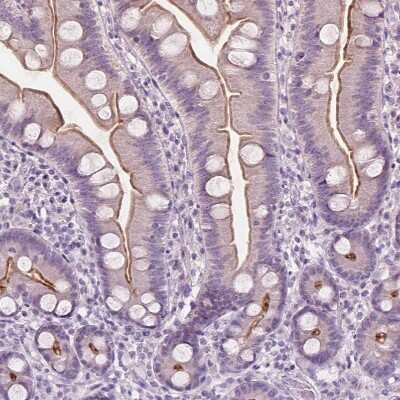 Immunohistochemistry-Paraffin: GPRC5A/RAI3 Antibody [NBP1-89743] - Staining of human small intestine shows moderate positivity in apical membrane in glandular cells.