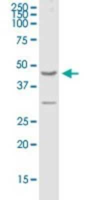 Western Blot: GPRC5A/RAI3 Antibody [H00009052-B01P] - Analysis of GPRC5A expression in human ovarian cancer.