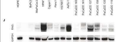 Western Blot: GPRC5A/RAI3 Antibody [NBP1-89743] - (J) RAI3 has a conspicuously low expression in BxPc3 and PaCaDD165 in comparison to the other cell lines in the group. (n = 3). (PLoS One. 2017; 12 (1): e0170390. Published online 2017 Jan 23.)
