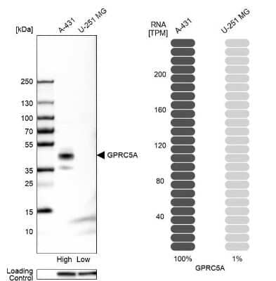 <b>Orthogonal Strategies Validation. </b>Western Blot: GPRC5A/RAI3 Antibody [NBP1-89743] - Analysis in human cell lines A-431 and U-251MG using anti-GPRC5A antibody. Corresponding GPRC5A RNA-seq data are presented for the same cell lines. Loading control: anti-HSP90B1.