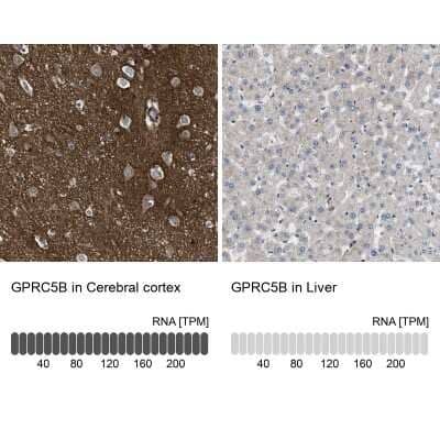 Immunohistochemistry-Paraffin GPRC5B Antibody - BSA Free
