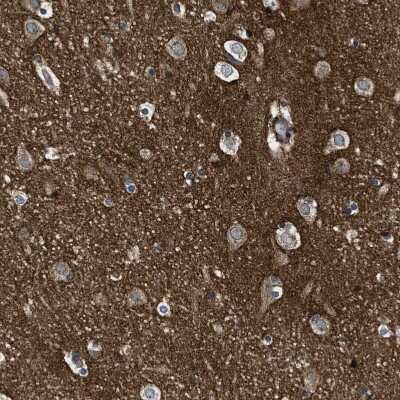 Immunohistochemistry-Paraffin GPRC5B Antibody - BSA Free