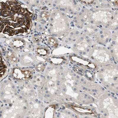 Immunohistochemistry-Paraffin: GPRC5B Antibody [NBP1-87160] - Staining of human kidney shows strong membranous positivity in cells in glomeruli and distal tubules.
