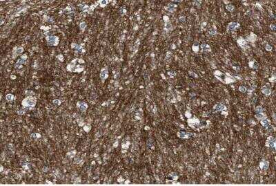 Immunohistochemistry-Paraffin: GPRC5B Antibody [NBP1-87160] - Staining of human caudate putamen shows strong membranous positivity in glial cells.
