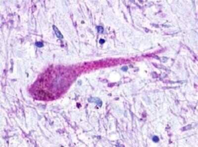 Immunohistochemistry-Paraffin: GPRC5B Antibody [NLS412] - Analysis of anti-GPRC5B antibody with human brain, neurons and glia.