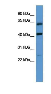 Western Blot: GPRC5B Antibody [NBP1-69040] - Human Muscle lysate, concentration 0.2-1 ug/ml.