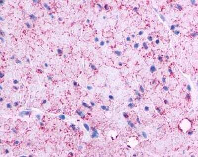 Immunohistochemistry-Paraffin: GPRC5C Antibody [NLS4077] - Analysis of anti-GPRC5C antibody with stomach, muscularis propria at 36 ug/ ml.