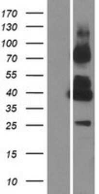 Western Blot: GPRC5C Overexpression Lysate (Adult Normal) [NBP2-11271] Left-Empty vector transfected control cell lysate (HEK293 cell lysate); Right -Over-expression Lysate for GPRC5C.