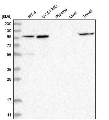 Western Blot: GPRIN1 Antibody [NBP2-55391] - Analysis in human cell line RT-4, human cell line U-251 MG, human plasma, human liver tissue and human tonsil tissue.