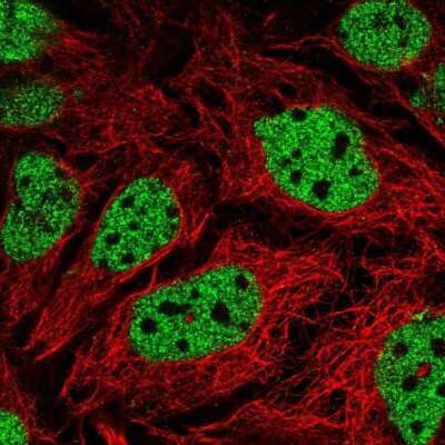 Immunocytochemistry/Immunofluorescence: GPS2 Antibody [NBP2-57050] - Staining of human cell line CACO-2 shows localization to nucleoplasm.