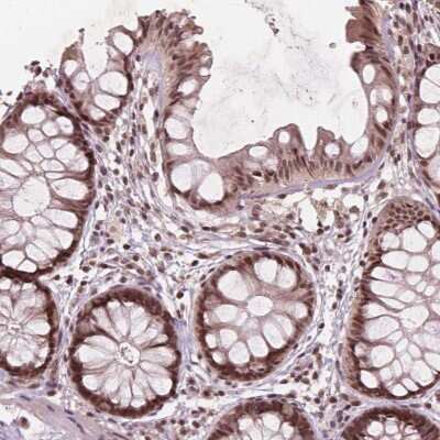Immunohistochemistry-Paraffin: GPS2 Antibody [NBP2-57050] - Staining of human colon shows moderate nuclear positivity in glandular cells.