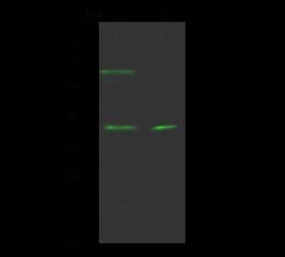 Western Blot: GPS2 Antibody [NBP2-98998] - Anti-GPS2 rabbit polyclonal antibody at 1:500 dilution. Lane A: A431 Whole Cell Lysate. Lane B: HeLa Whole Cell Lysate. Lysates/proteins at 30 ug per lane. Secondary Goat Anti- Rabbit IgG H&L (Dylight 800) at 1/10000 dilution. Developed using the Odyssey technique. Performed under reducing conditions. Predicted band size: 37 kDa. Observed band size: 39 kDa (We are unsure as to the identity of these extra bands).