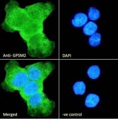 Immunocytochemistry/Immunofluorescence: GPSM2 Antibody [NB100-57096] - Analysis of paraformaldehyde fixed A431 cells, permeabilized with 0.15% Triton. Primary incubation 1hr (10ug/ml) followed by Alexa Fluor 488 secondary antibody (2ug/ml), showing cytoplasmic staining. The nuclear stain is DAPI (blue). Negative control: Unimmunized goat IgG (10ug/ml) followed by Alexa Fluor 488 secondary antibody (2ug/ml).