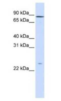 Western Blot: GPSM2 Antibody [NBP1-53125] - Human Fetal Liver Lysate, concentration 1ug/ml.