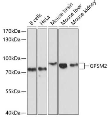 Western Blot: GPSM2 Antibody [NBP3-05001] - Analysis of extracts of various cell lines, using GPSM2 antibody at 1:1000 dilution. Secondary antibody: HRP Goat Anti-Rabbit IgG (H+L) at 1:10000 dilution. Lysates/proteins: 25ug per lane. Blocking buffer: 3% nonfat dry milk in TBST. Detection: ECL Basic Kit