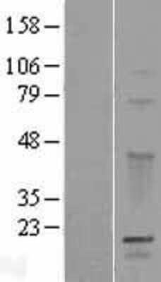 Western Blot: GPSM3 Overexpression Lysate (Adult Normal) [NBP2-06471] Left-Empty vector transfected control cell lysate (HEK293 cell lysate); Right -Over-expression Lysate for GPSM3.