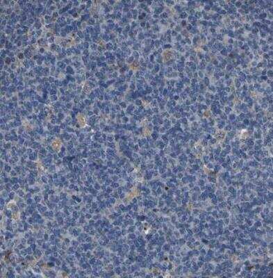 Immunohistochemistry-Paraffin: GRAMD1A Antibody [NBP1-93729] - Staining of human tonsil shows negative cytoplasmic positivity in germinal center cells as expected.