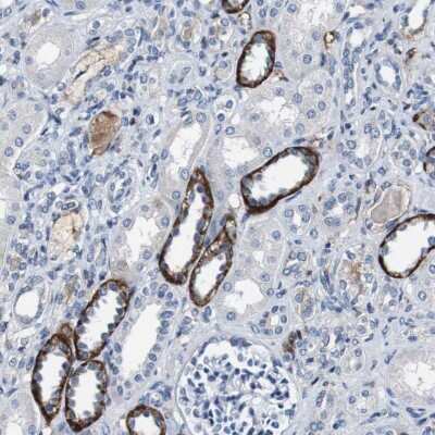 <b>Orthogonal Strategies Validation. </b>Immunohistochemistry-Paraffin: GRAMD1A Antibody [NBP1-93730] - Staining of human kidney shows strong cytoplasmic positivity in cells in tubules.