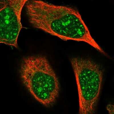 Immunocytochemistry/Immunofluorescence: GRAMD2 Antibody [NBP1-86357] - Immunofluorescent staining of human cell line U-2 OS shows localization to nucleoli, nuclear speckles & cytosol.