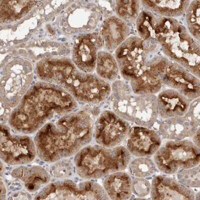 Immunohistochemistry-Paraffin: GRAMD2 Antibody [NBP1-86357] - Staining of human kidney shows strong cytoplasmic and membranous positivity in tubule cells.