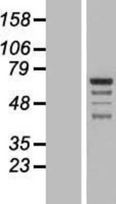 Western Blot: GRAMD4 Overexpression Lysate (Adult Normal) [NBP2-07212] Left-Empty vector transfected control cell lysate (HEK293 cell lysate); Right -Over-expression Lysate for GRAMD4.