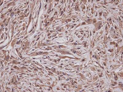 Immunohistochemistry-Paraffin: GRAP Antibody [NBP1-33626] - Paraffin-embedded U37C xenograft, using antibody at 1:100 dilution.