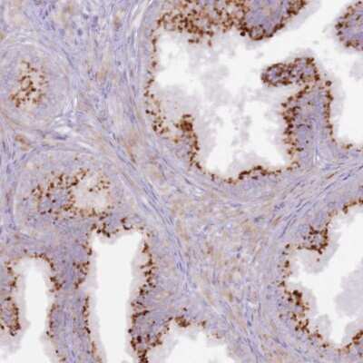 Immunohistochemistry-Paraffin: GRAP Antibody [NBP1-91969] - Staining of human prostate shows strong cytoplasmic positivity in glandular cells.